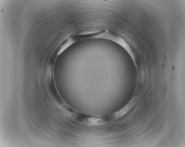 X0000087520172200705112015