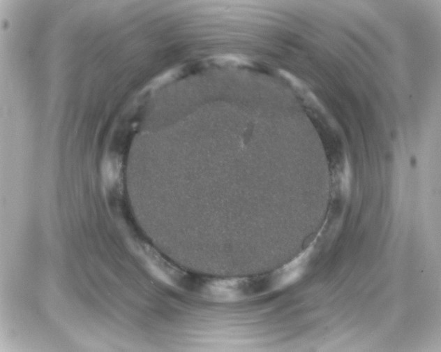 X0000087520178200705112015