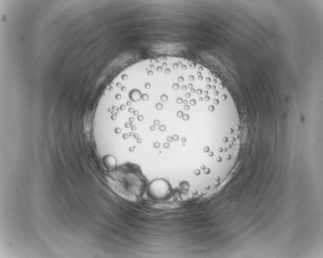 X0000087520179200705112015