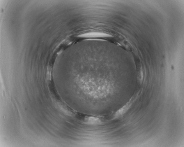 X0000087520180200705112015