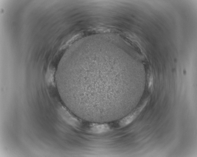 X0000087520185200705112015