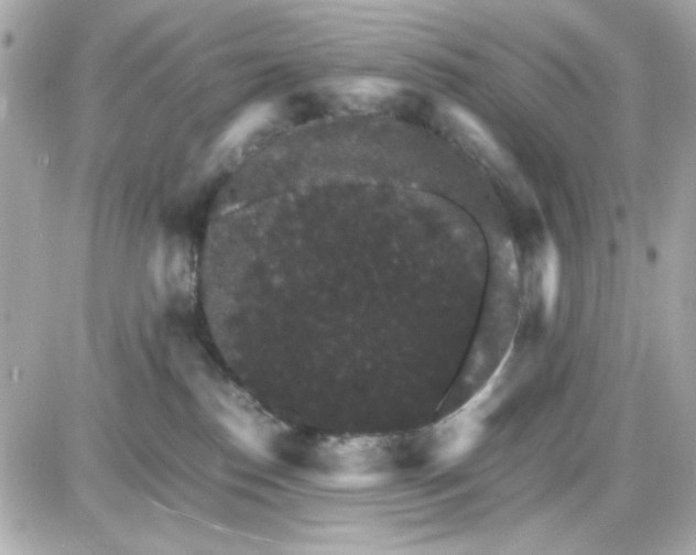 X0000087520186200705112015