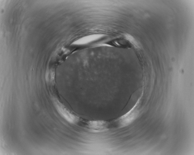 X0000087520192200705112015