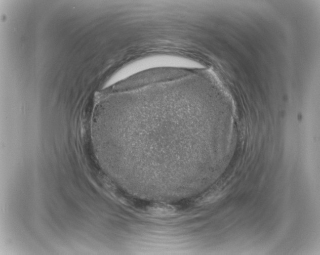 X0000087520215200705112014