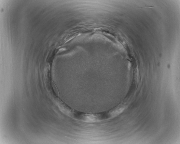 X0000087520229200705112014