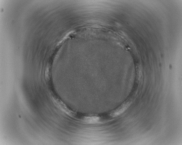 X0000087520266200705112014