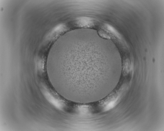 X0000087520268200705112014