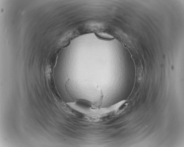 X0000087520279200705112014