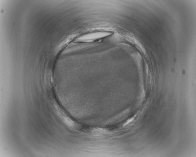 X0000087520397200705112011