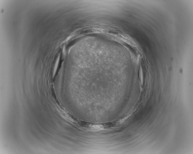 X0000087520409200705112011