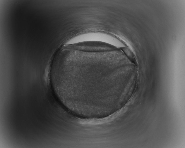 X0000087520009200705181021