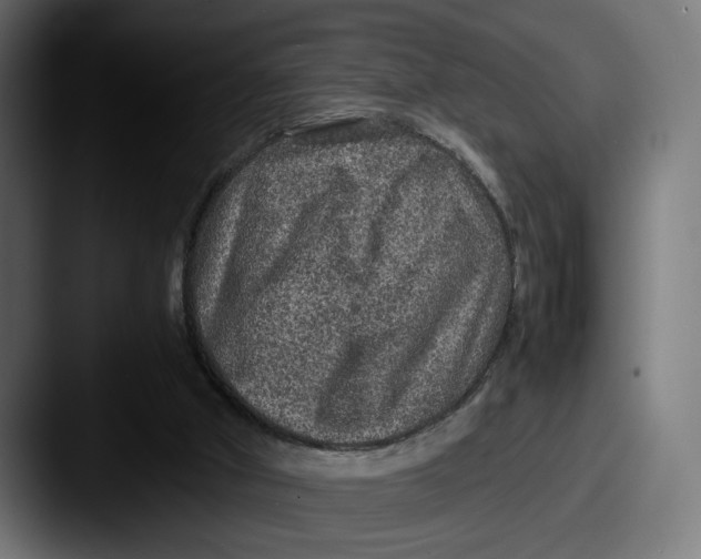 X0000087520010200705181021