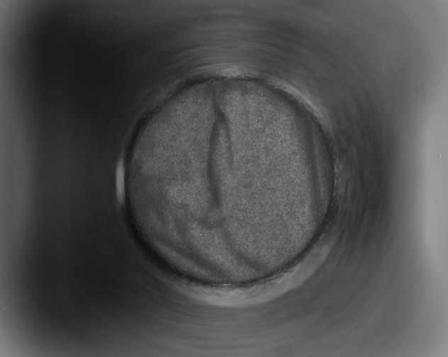 X0000087520014200705181020