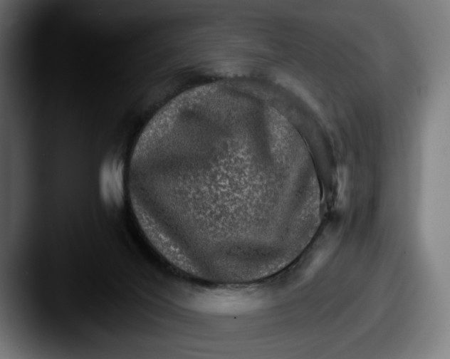 X0000087520020200705181020