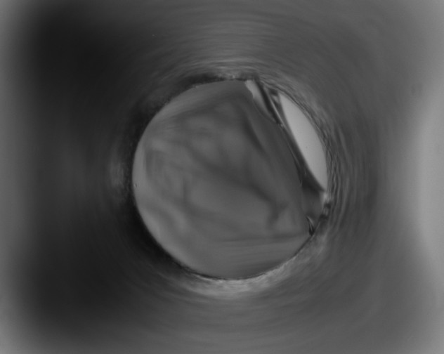 X0000087520031200705181020