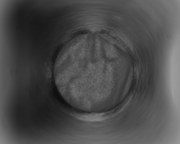 X0000087520032200705181020