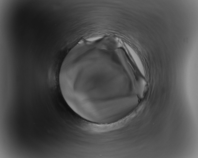 X0000087520039200705181020