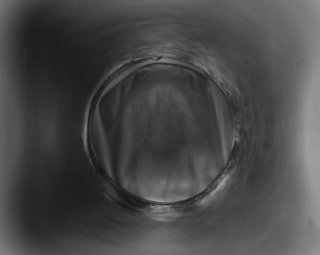 X0000087520052200705181020