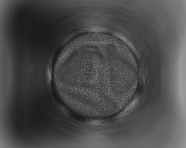 X0000087520062200705181020