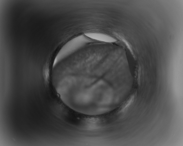 X0000087520067200705181020