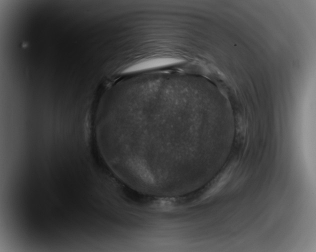 X0000087520080200705181020