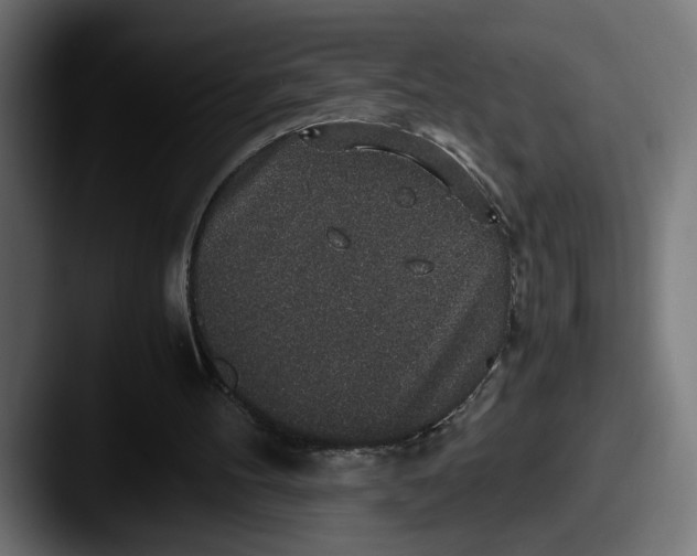 X0000087520100200705181019