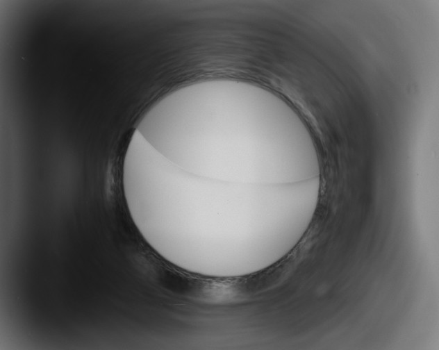 X0000087520114200705181019