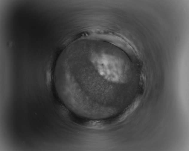 X0000087520117200705181019