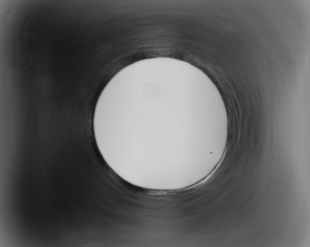 X0000087520144200705181019