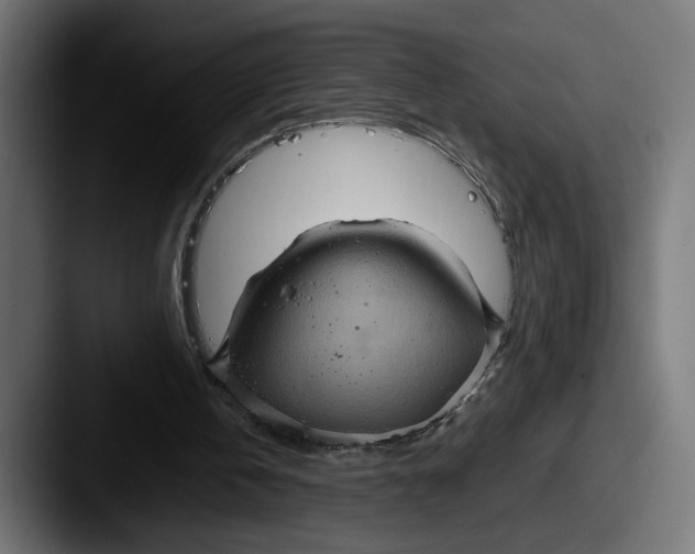 X0000087520146200705181018