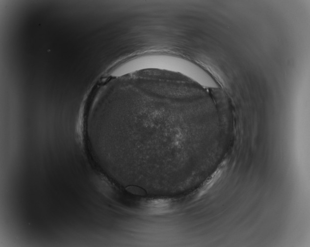 X0000087520156200705181019