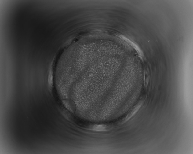 X0000087520157200705181019