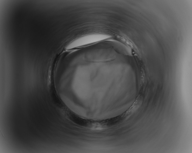 X0000087520163200705181019