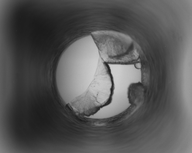 X0000087520165200705181019