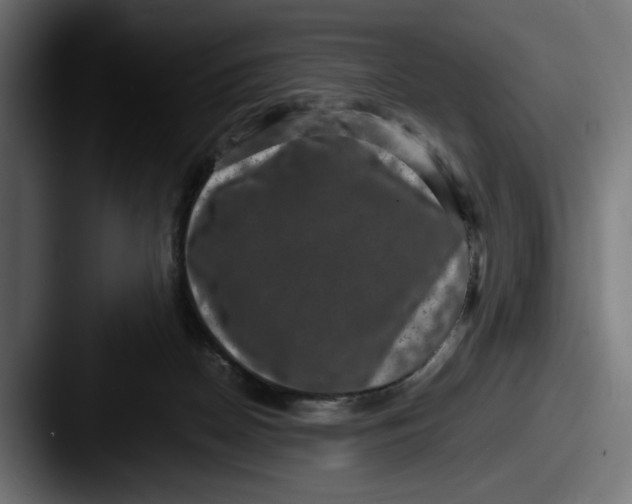 X0000087520170200705181019