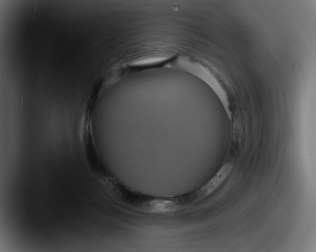 X0000087520172200705181019