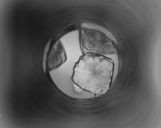 X0000087520177200705181019