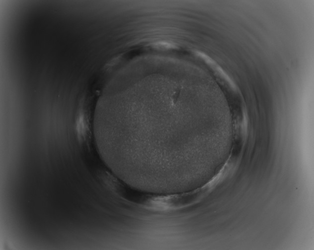 X0000087520178200705181019