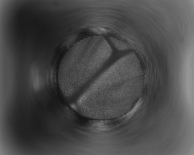 X0000087520182200705181019