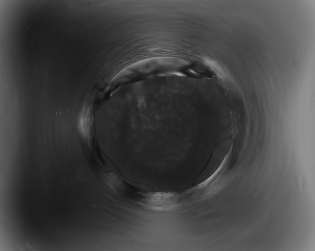 X0000087520192200705181019