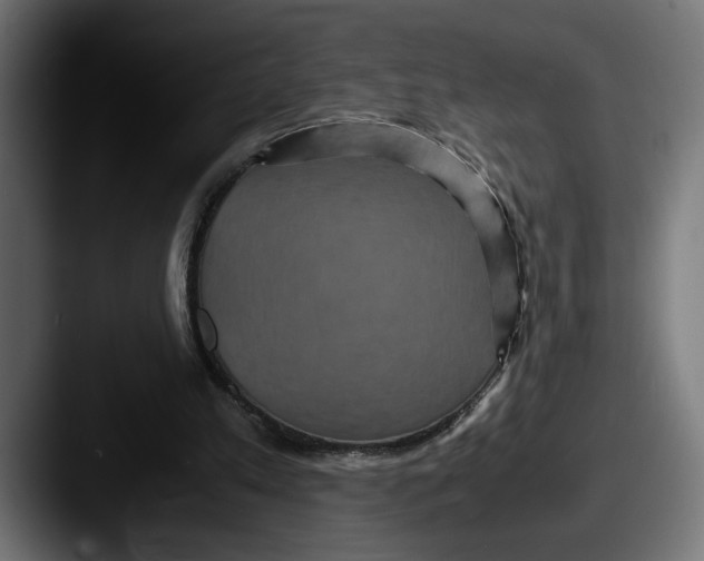 X0000087520197200705181018