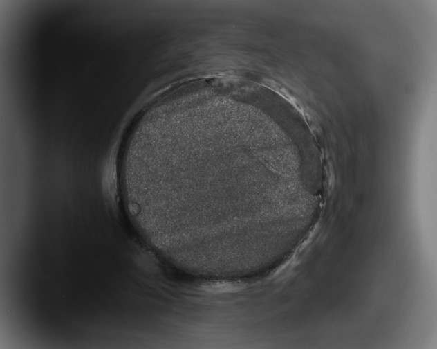 X0000087520198200705181018