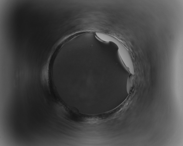 X0000087520200200705181018