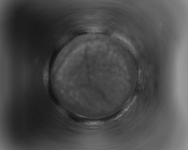 X0000087520202200705181018