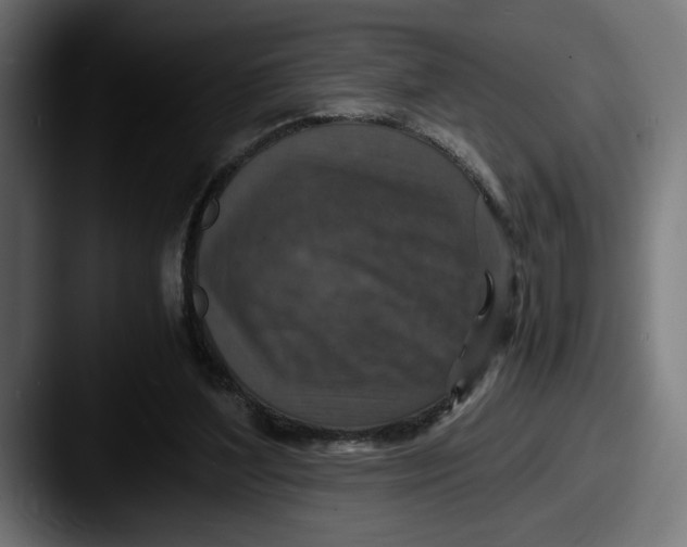 X0000087520204200705181018