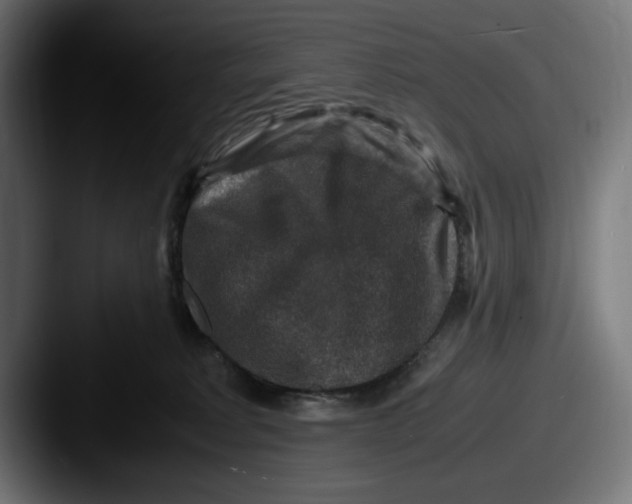 X0000087520229200705181018