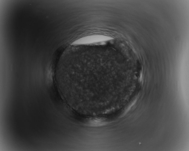 X0000087520235200705181018