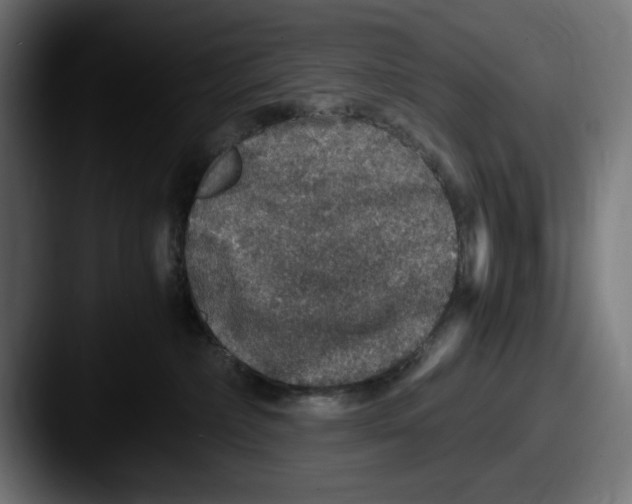 X0000087520236200705181018