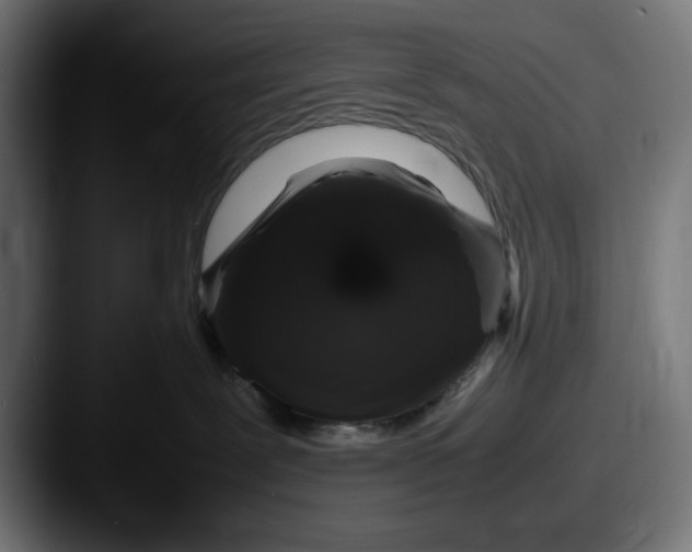 X0000087520239200705181018