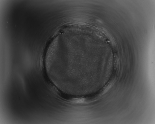 X0000087520266200705181018